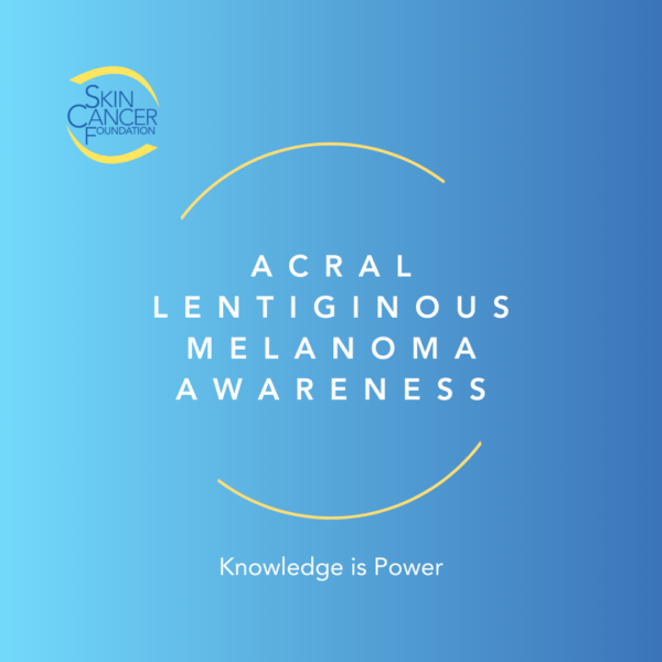 Acral Melanoma Awareness Acral melanoma awareness badge