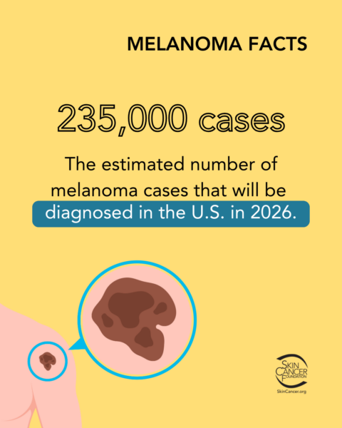 melanoma facts 235k cases